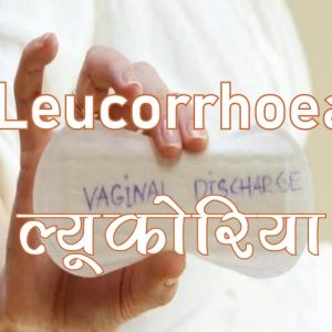 Leucorrhoea Medicine, ल्यूकोरिया की दवा