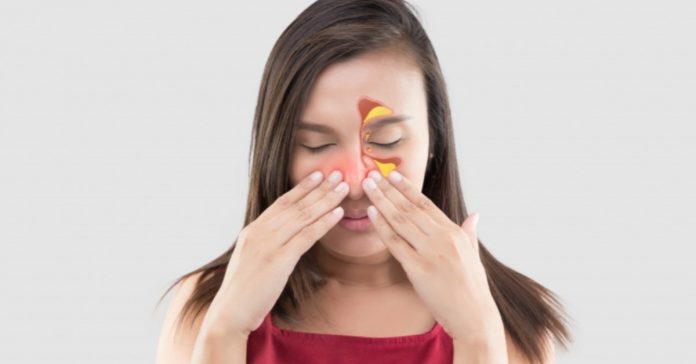 Sinus Treatment - नाक की इस परेशानी का इलाज, 3 Tips